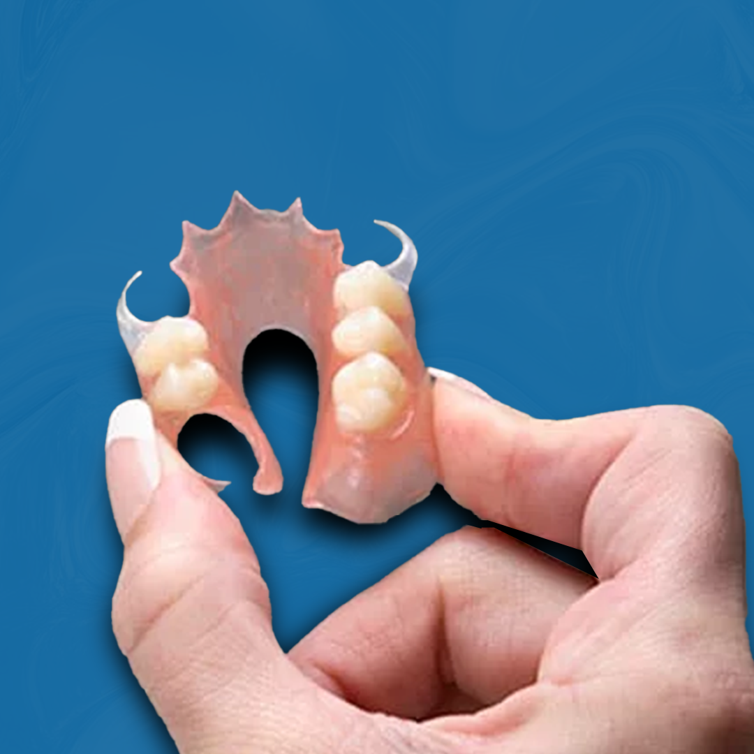 Flexible Dentures (4–8 Teeth)