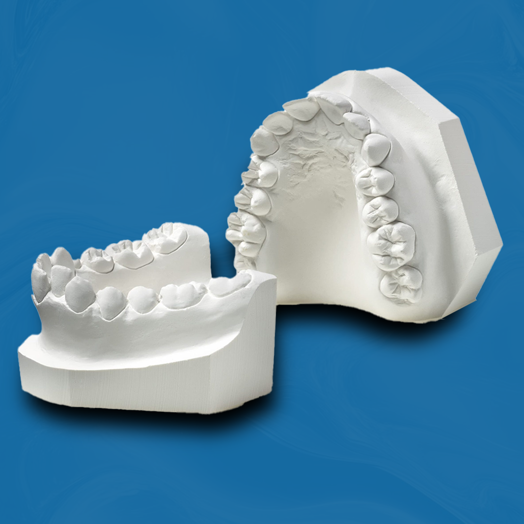 Orthodontic Study Model